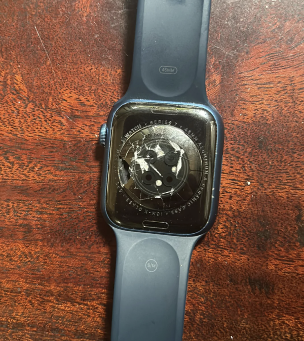 戴智能手錶訓覺好危險？Apple Watch 驚現灼傷手腕 維權半年官方竟然咁處理？【附 5 招睡眠安全佩戴貼士】