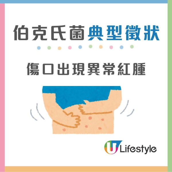 4款濕紙巾藏致命細菌！有毒濕紙巾抹傷口感染恐致敗血症/器官衰竭 (附消委會推薦濕紙巾)