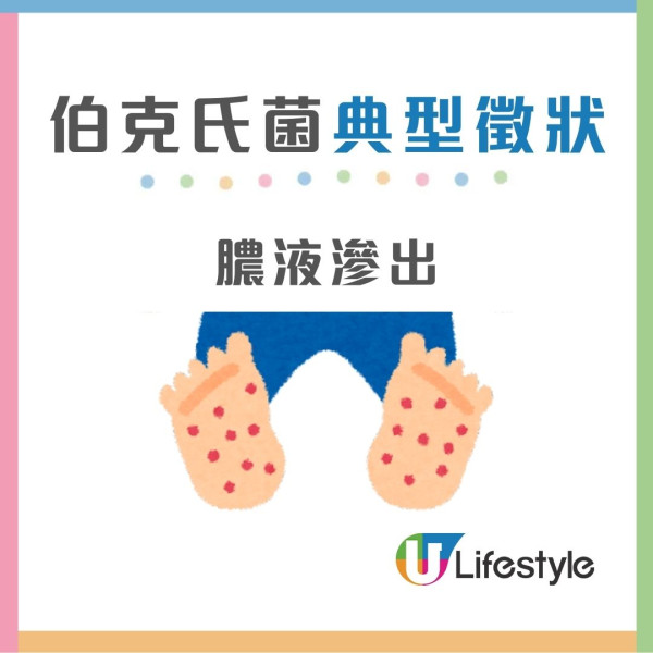 4款濕紙巾藏致命細菌！有毒濕紙巾抹傷口感染恐致敗血症/器官衰竭 (附消委會推薦濕紙巾)