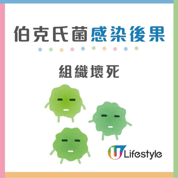 4款濕紙巾藏致命細菌！有毒濕紙巾抹傷口感染恐致敗血症/器官衰竭 (附消委會推薦濕紙巾)