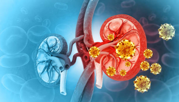 14歲香港學生洗腎換腎！醫生揭3大高危成因/10大傷腎食物排行榜 珍奶排第1