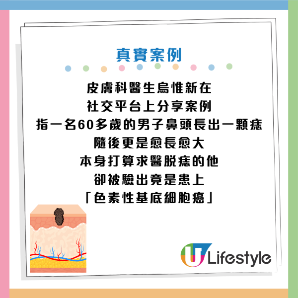 圖片資料來源：Facebook@皮膚專科 烏惟新醫師