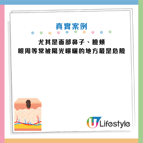 圖片資料來源：Facebook@皮膚專科 烏惟新醫師