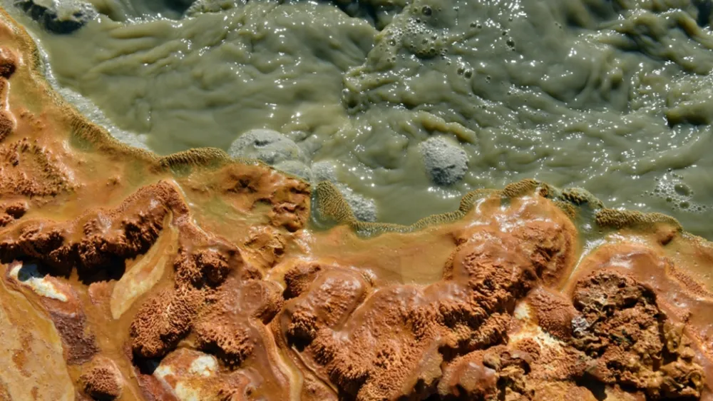 飲水少、愛食加工品？最新10大傷腎行為排行榜出爐 第一名可能每天都在做！