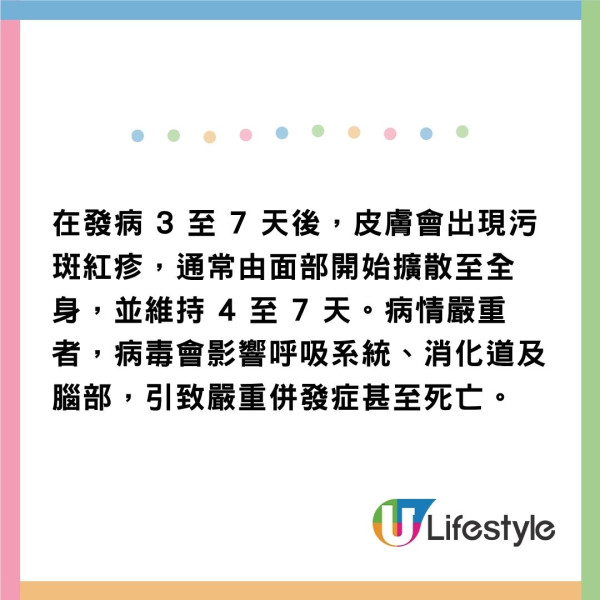 東京麻疹個案急增！ 新宿食肆爆集體感染 今年病例已追平去年總數 