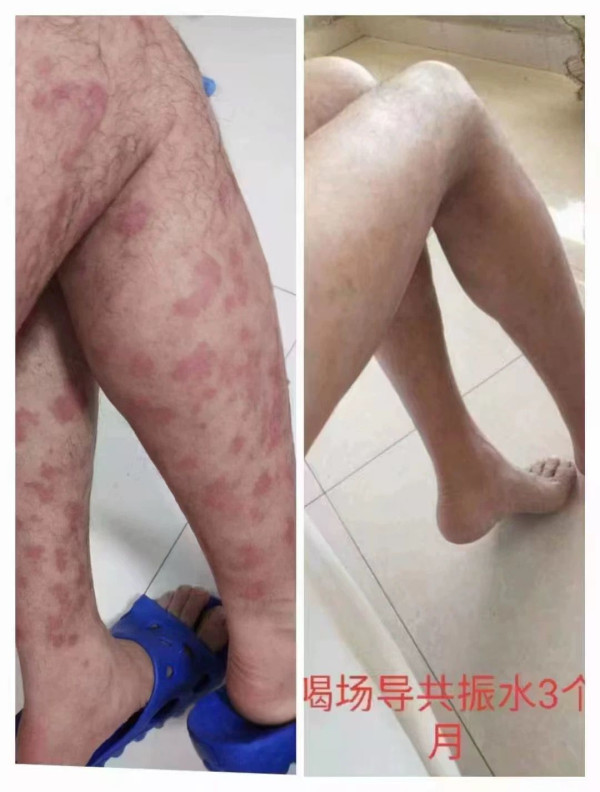 專呃長者！央視揭「神仙水機」騙局 謊稱飲完中風行得返 專家拆解真身