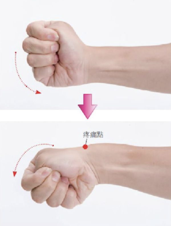 手痛晚期可致永久功能喪失？ 一文睇清「手機手」同「滑鼠手」教你3秒極速自查【附 5 分鐘恢復運動】