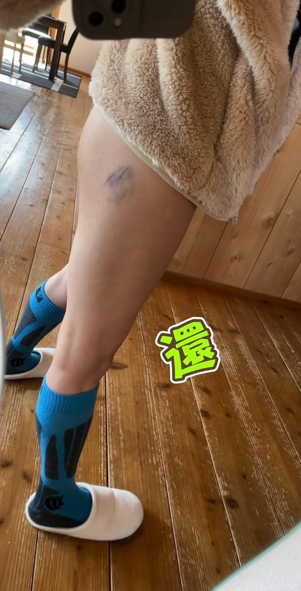 照片來源:Instagram@chiuskinny 照片來源:Instagram@chiuskinny