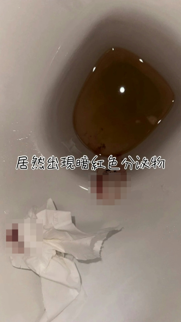 31歲前港姐宣佈懷孕驚曝流產跡象 心情跌落谷底：發現出血的那一刻