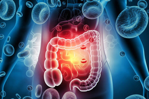 以為無咁黑仔？50歲婦大腸癌拒做手術！僅5個月惡化轉移肝臟 醫生嘆：絕非特例