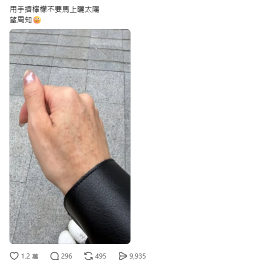 擠檸檬起巨型水泡險毀容！揭恐怖化學灼傷真相 24小時後噩夢開始