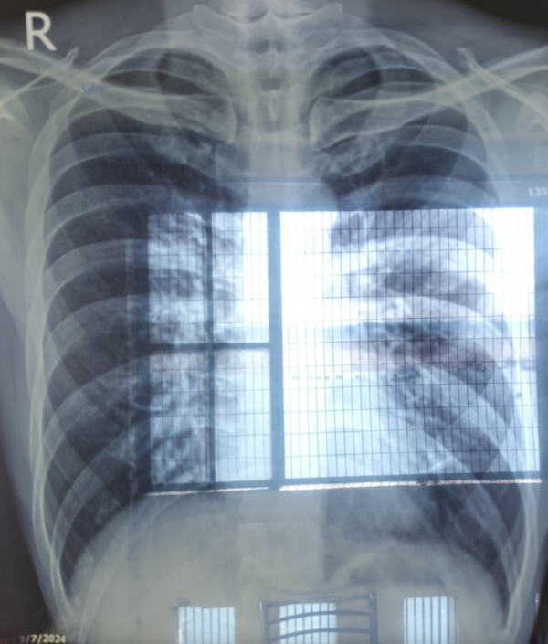 照片來源：X@DotabataGG