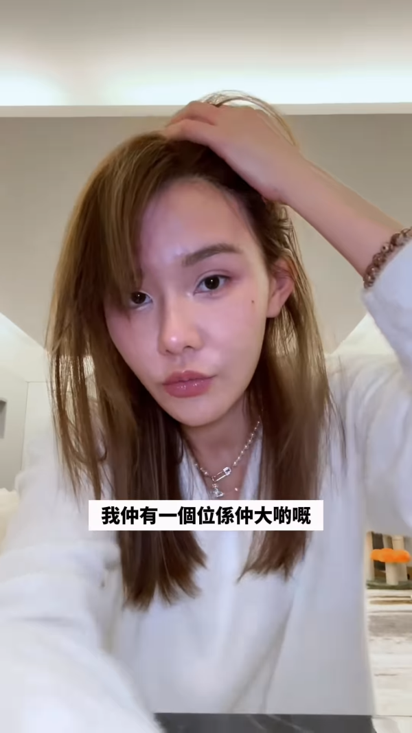 五索承認鬼剃頭「禿到唔會再有反應」情況惡化兩側寸草不生畫面觸目驚心