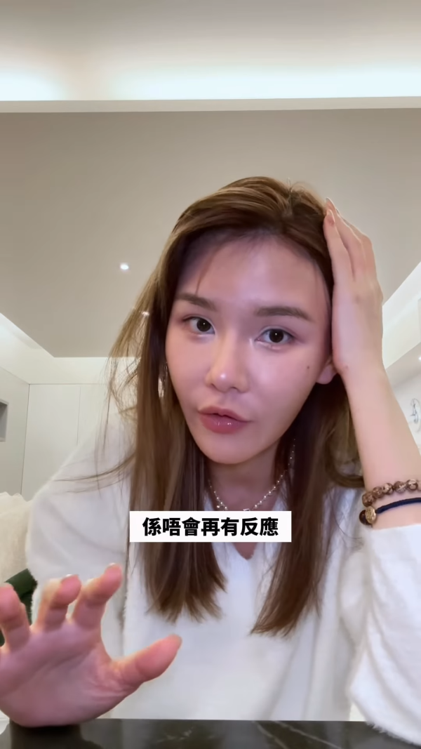 五索承認鬼剃頭「禿到唔會再有反應」情況惡化兩側寸草不生畫面觸目驚心