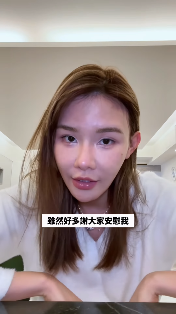 五索承認鬼剃頭「禿到唔會再有反應」情況惡化兩側寸草不生畫面觸目驚心