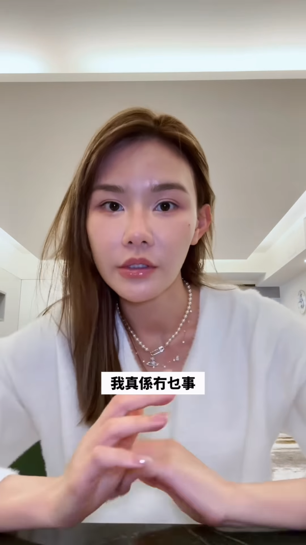 五索承認鬼剃頭「禿到唔會再有反應」情況惡化兩側寸草不生畫面觸目驚心