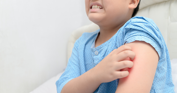 麻疹殺入香港機場！268人列密切接觸 病毒在空中可活2小時 可引發致命腦炎