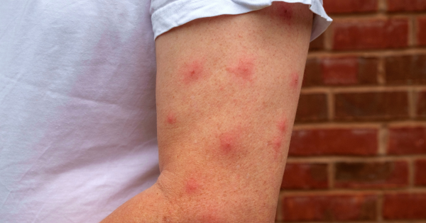 今年暴雨季提前！厄爾尼諾恐引爆史詩級蚊患 專家警告：呢幾個月高危