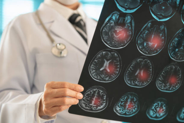 專家揭不吃早餐5大癌症風險增近6倍！醫生：或致缺血性腦中風／女子因此生60粒膽石...