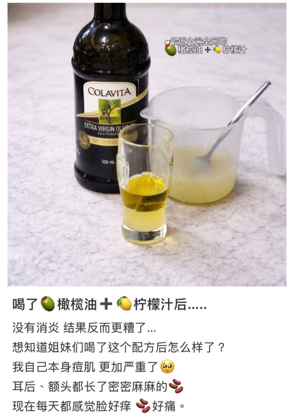 U Food專訪｜張員瑛橄欖油＋檸檬汁保養法爆紅！網民實測反爛面爆瘡/營養師：3類人切勿嘗試！