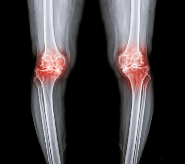 圖片來源：Canva