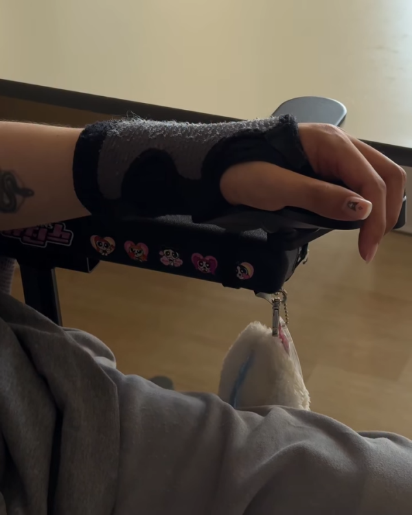 阿Mo李啟言IG晒康復進度突破掌控力大增！左手肌肉有力操作流暢展現強大意志