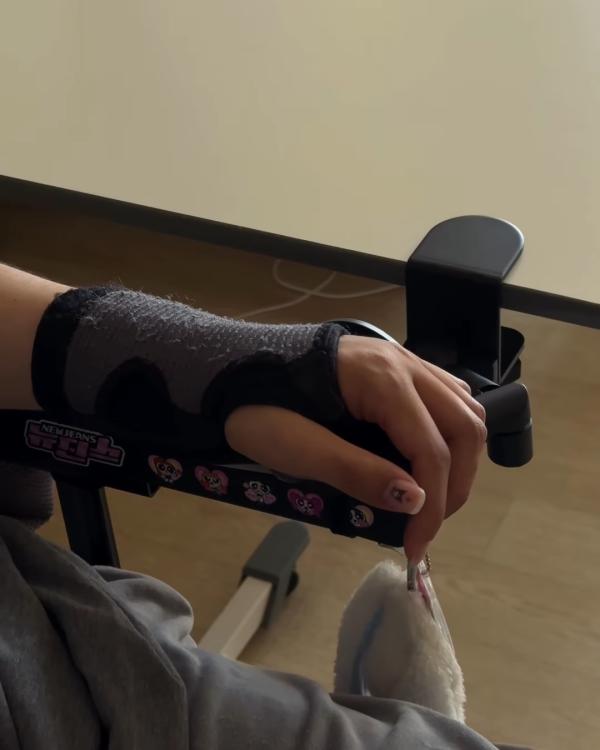 阿Mo李啟言IG晒康復進度突破掌控力大增！左手肌肉有力操作流暢展現強大意志