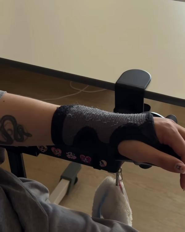 阿Mo李啟言IG晒康復進度突破掌控力大增！左手肌肉有力操作流暢展現強大意志