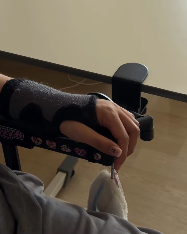 阿Mo李啟言IG晒康復進度突破掌控力大增！左手肌肉有力操作流暢展現強大意志