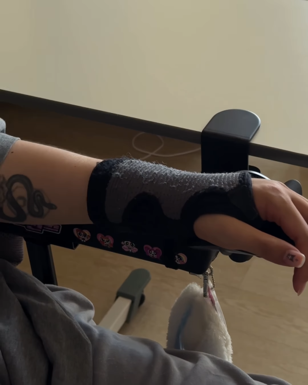 阿Mo李啟言IG晒康復進度突破掌控力大增！左手肌肉有力操作流暢展現強大意志