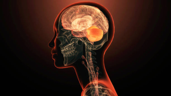 以為牙齦流血好小事？醫生警告：牙周病細菌恐逆流「蠶食大腦」 誘發阿茲海默症