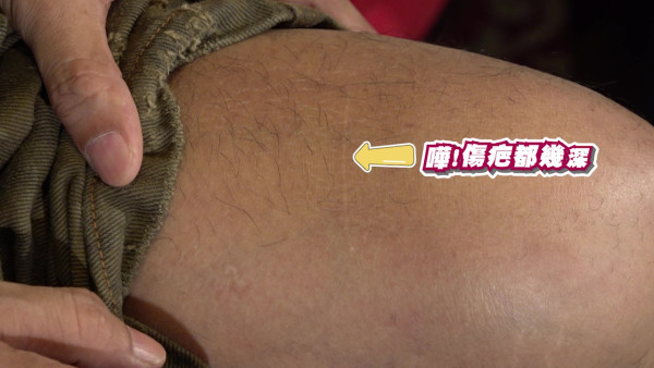 羅志祥自爆曾因肥胖慘遭同學霸凌！被箍頸剪頭髮、圓規𠝹大髀留疤至今