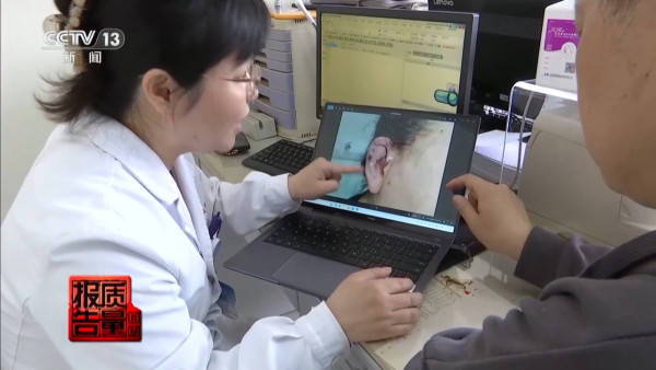 內地興起「精靈耳」整容手術熱潮 央視揭恐怖後果！最嚴重可致終身殘疾 