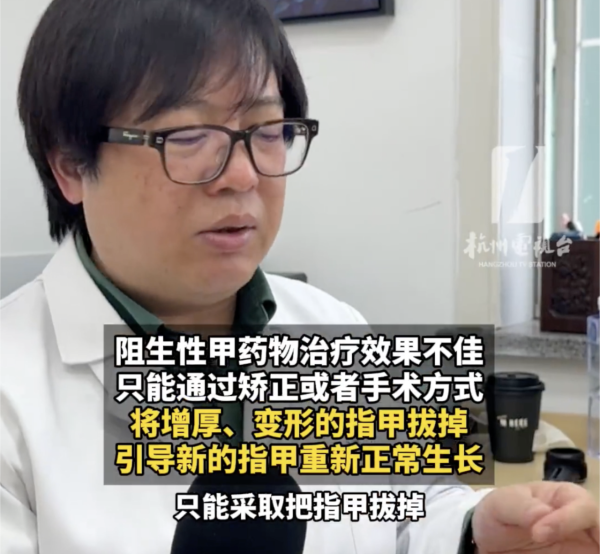 著襪瞓覺出事！腳趾慘變恐怖千層酥 醫生警告非灰甲只能拔除