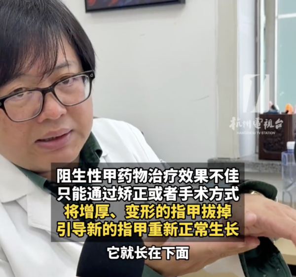 著襪瞓覺出事！腳趾慘變恐怖千層酥 醫生警告非灰甲只能拔除