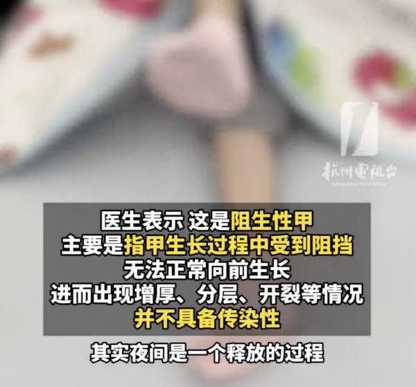 著襪瞓覺出事！腳趾慘變恐怖千層酥 醫生警告非灰甲只能拔除