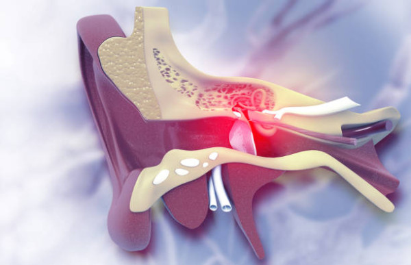 女子日日挖耳屎致「潰爛見骨」 確診患癌須切除左耳！醫生揭1致命動作/附正確清潔法