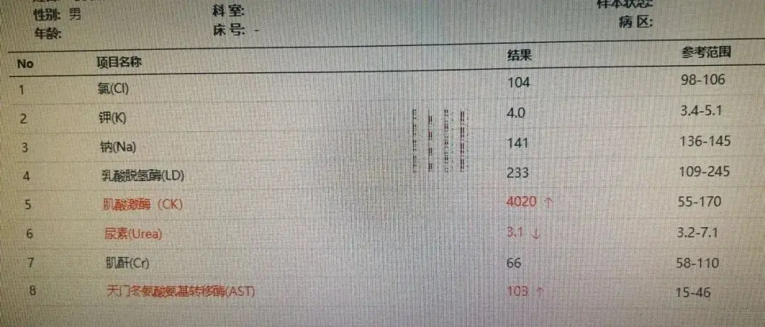 食小龍蝦隨時中伏？19歲男食後爆發橫紋肌溶解症！醫生警告：2個部位千萬別食 附食安中心3招防中伏指南