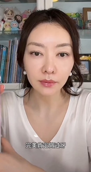 百億闊太直播親認「醫美肯定有做過」 屢被指變臉疑雲驚現蒜頭鼻進化