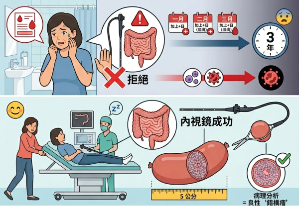 中年婦拒照大腸鏡拖足3年！腹腔驚見「香腸狀巨型瘜肉」醫警告：5大徵兆恐已變大腸癌