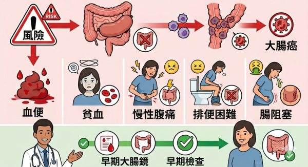 中年婦拒照大腸鏡拖足3年！腹腔驚見「香腸狀巨型瘜肉」醫警告：5大徵兆恐已變大腸癌