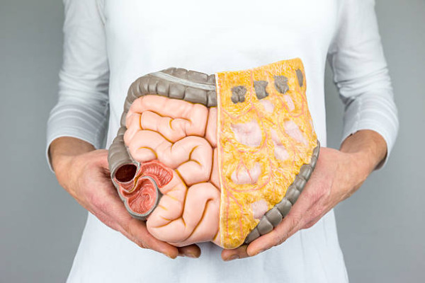 以為戒飯減糖就健康？醫生警告狂食1款食物脂肪恐活埋胰臟+誘發糖尿病