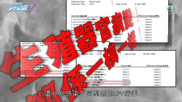21岁播毒男疑有反转内幕?医生拆解HPV型号不同两大关键 不排除透过其他性伴侣感染