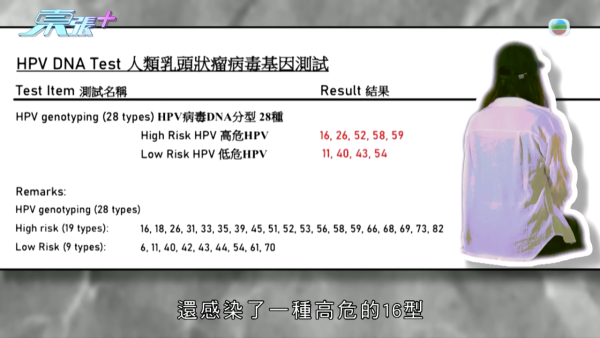 21岁播毒男疑有反转内幕?医生拆解HPV型号不同两大关键 不排除透过其他性伴侣感染