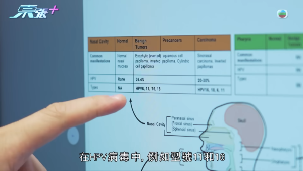 21岁播毒男疑有反转内幕?医生拆解HPV型号不同两大关键 不排除透过其他性伴侣感染