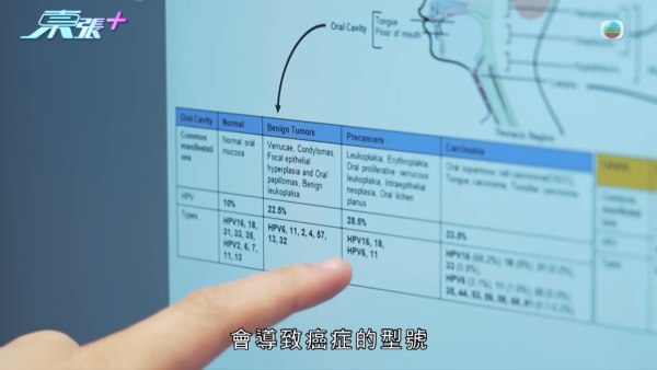 21岁播毒男疑有反转内幕?医生拆解HPV型号不同两大关键 不排除透过其他性伴侣感染