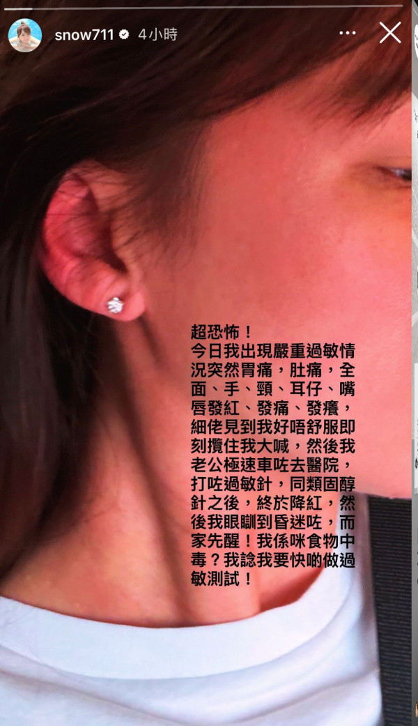孙慧雪惊爆严重急性过敏送院！毁容级红肿画面曝光吓到5岁细仔爆哭