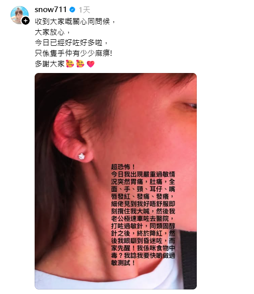 孙慧雪惊爆严重急性过敏送院！毁容级红肿画面曝光吓到5岁细仔爆哭