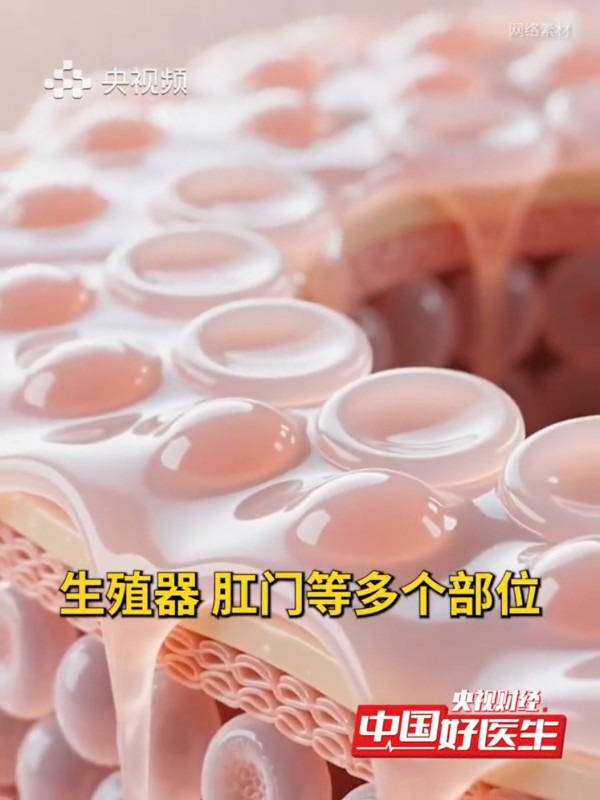 游水、浸溫泉會傳染HPV病毒嗎？名醫拆解2大日常感染隱患：座廁與「它」恐引毒入身