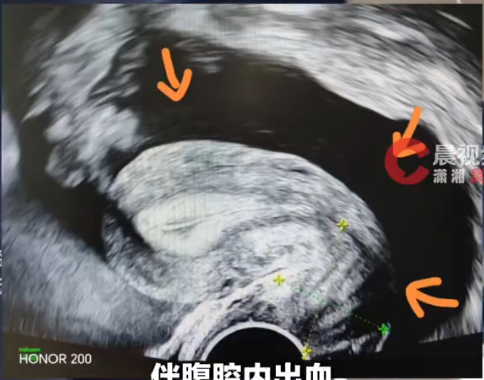 圖片資料來源:《瀟湘晨報》